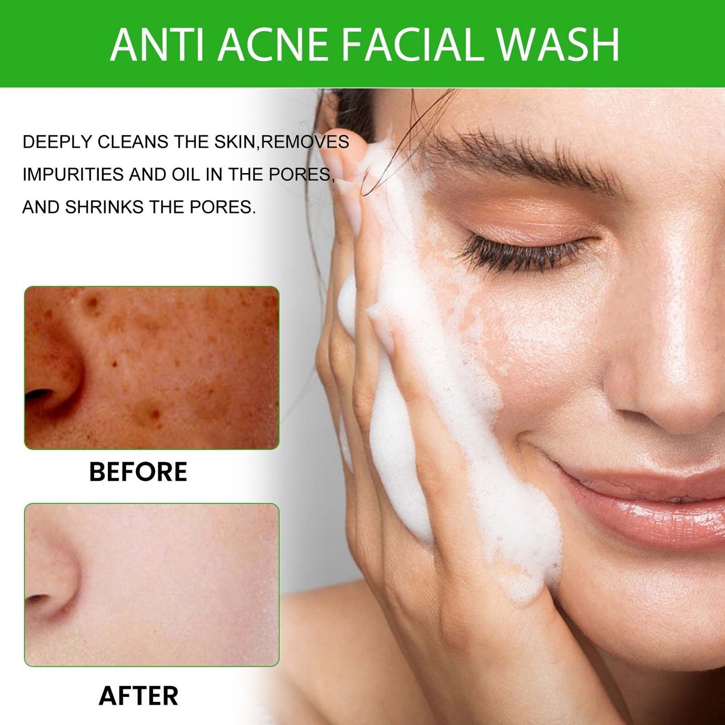 Facial Wash
Anti Acne
Amino Acid